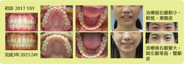 請聽我解讀 ＂明眸皓齒 ＂