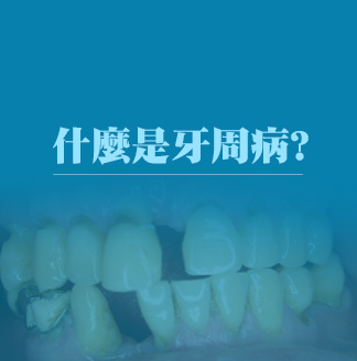 什麼是牙周病 ?